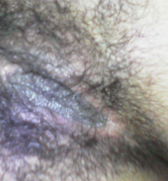 pobrazafilia 2