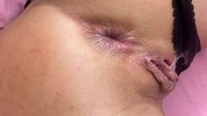 butthole 4